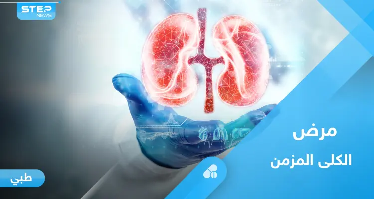 ما هو مرض الكلى المزمن.. إليك أهم المعلومات: أخبار