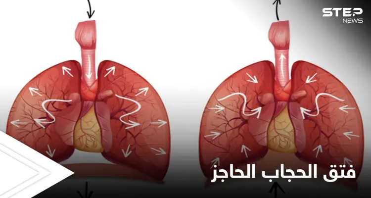 ما هي وظيفة الحجاب الحاجز وكيف يتم علاجه عن طريق العمل الجراحي إليك أهم المعلومات: أخبار