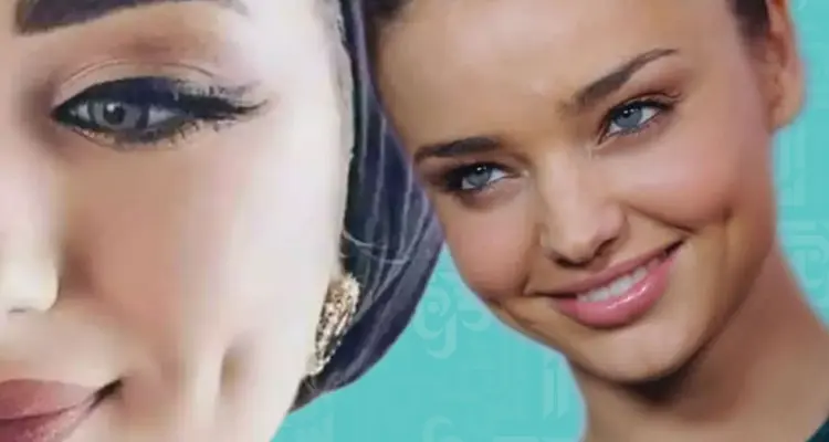 عمل الغمازات بالليزر خلال 10 دقائق.. الأضرار والفوائد مع التكلفة: أخبار