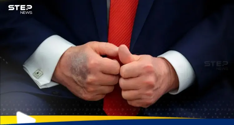 "ترامب مات" وسم يتصدر مواقع التواصل الاجتماعي.. ومسؤول أمريكي يعلق: أخبار