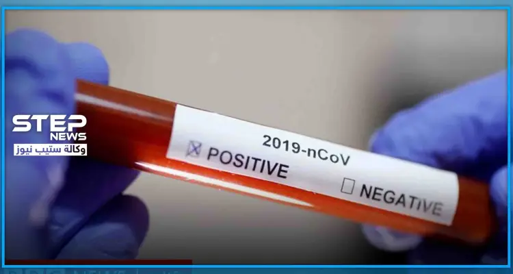 "الوراثة" لها الدور على قدرة تحمل الإنسان الإصابة بالكورونا ومقاومته للموت: أخبار