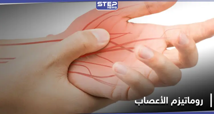 ما هو مرض روماتيزم الأعصاب.. أعراضه الــ"9" وطرق علاجه: أخبار