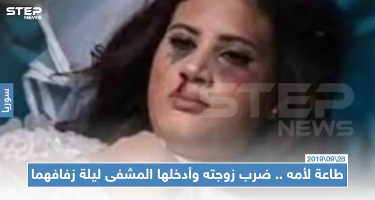 سمع كلام أمه وضرب زوجته ليلة زفافهما فأدخلها إلى العناية المركزة: أخبار