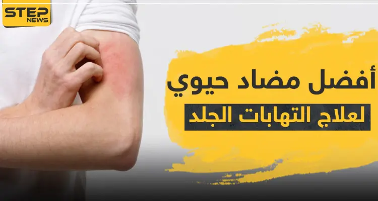 8 أسماء ... أفضل مضاد حيوي لعلاج التهابات الجلد: أخبار