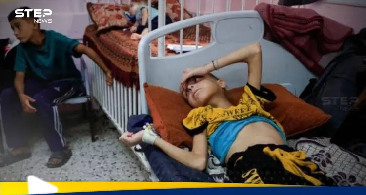 الصحة العالمية تكشف عدد الأشخاص الذين ماتوا بسبب سوء التغذية في غزة هذا العام: أخبار