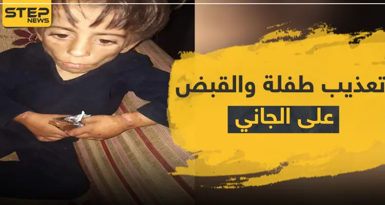 بالصور|| طفلة تتعرض لأبشع أنواع التعذيب على يد والدها والمعارضة السورية تقبض عليه: أخبار