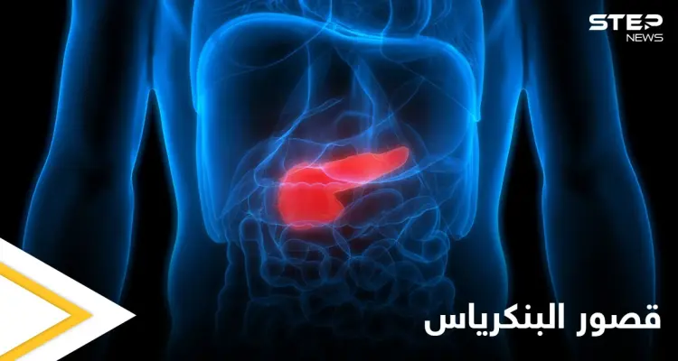 خطورة قصور البنكرياس وآثاره الصحية وطرق العلاج إليك أهم المعلومات: أخبار