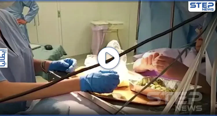 بالفيديو|| في حدث نادر لا يتكرر كثيراً.. سيدة تعد الطعام خلال خضوعها لعملية بالدماغ: أخبار
