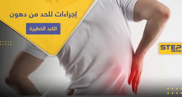 هل يستطيع شرب الماء معالجة مرض " التنكس الكبدي الدهني" الخطير (دهون الكبد) .. إليك الحقيقة: أخبار