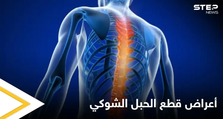 تعرف على أنواع وأعراض قطع الحبل الشوكي وطرق العلاج: أخبار
