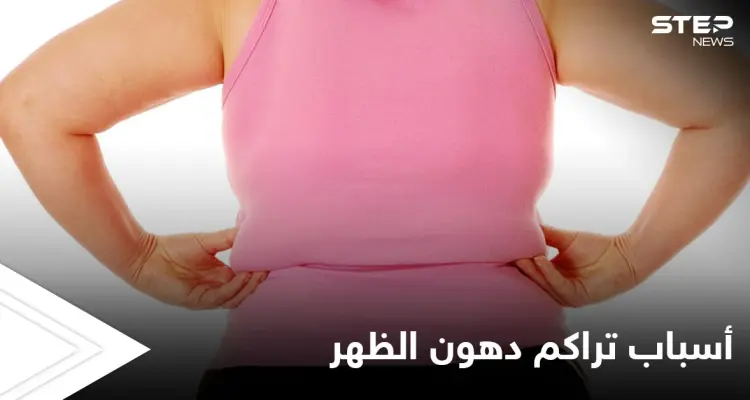 تعرف على أسباب تراكم دهون الظهر وطرق بسيطة للتخلص منها: أخبار