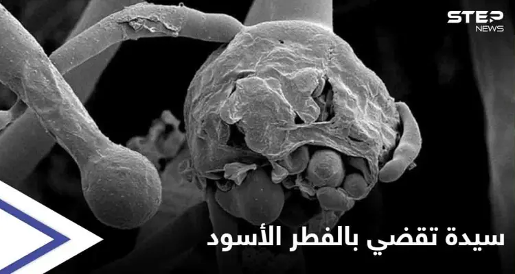 وفاة أول سيدة عربية يشتبه بإصابتها بـ الفطر الأسود: أخبار