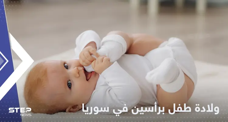 شاهد|| حالة طبية نادرة.. ولادة طفل برأسين في إدلب شمال سوريا: أخبار