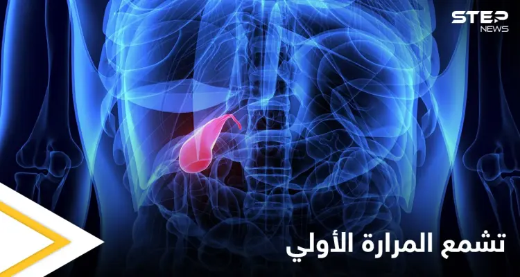 من أخطر الأمراض تشمع المرارة الأولي أسبابه وأعراضه وأهم المعلومات عنه: أخبار