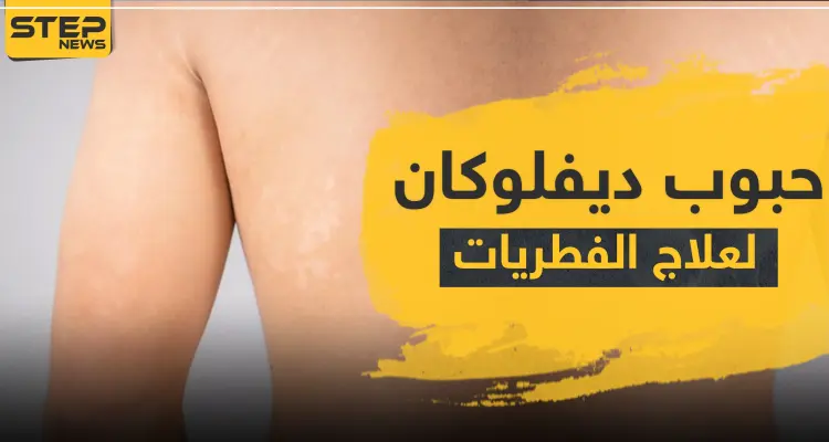 حبوب ديفلوكان لعلاج الفطريات: أخبار