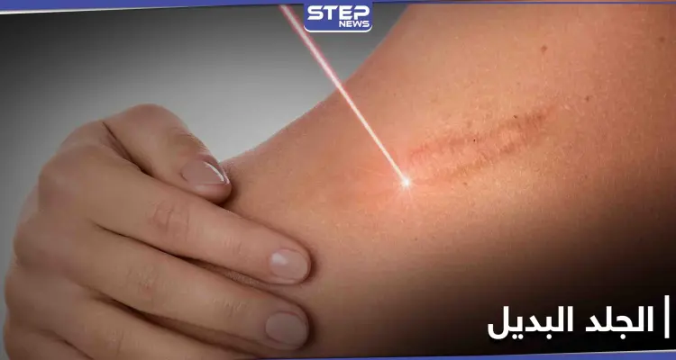 مسدس طبي.. اختراق يولد جلداً بديلاً ويغطي الحروق: أخبار