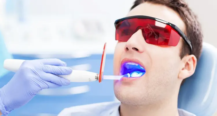 تبييض الأسنان بالليزر.. طريقة العملة وأضرارها وفوائدها مع تكلفة إجرائها: أخبار