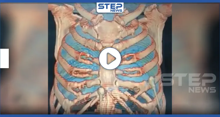 شاهد مراحل تغلغل فيروس كورونا وتأثيره على جسم الإنسان خطوة بخطوة (فيديو): أخبار