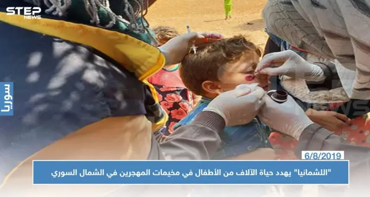 "اللشمانيا" يهدد حياة الآلاف من الأطفال في مخيمات المهجرين في الشمال السوري: أخبار
