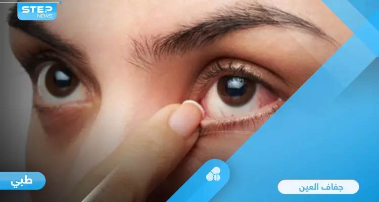 أسباب جفاف العين ومضاعفاته على البصر وطرق العلاج: أخبار