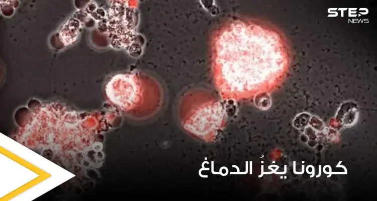 بالفيديو|| في تصوير نادر.. فيديو يوثق كيف يغزو فيروس كورونا خلايا الدماغ: أخبار