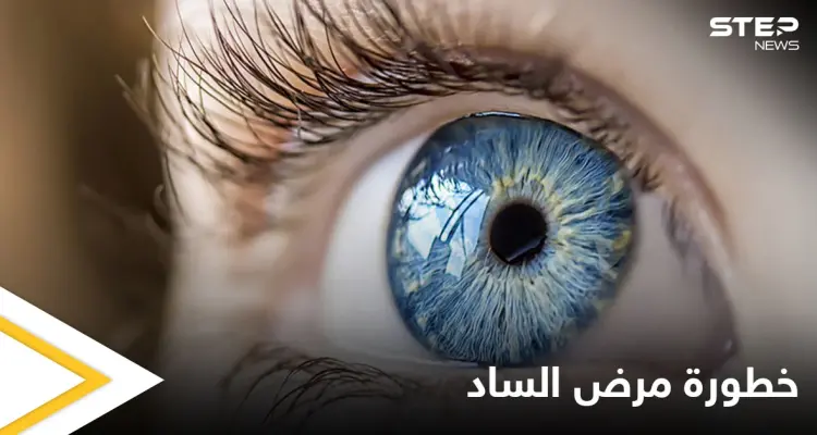 أكثر أمراض العين خبثاً.. ما هو مرض الساد وماهي أسبابه إليك التفاصيل: أخبار