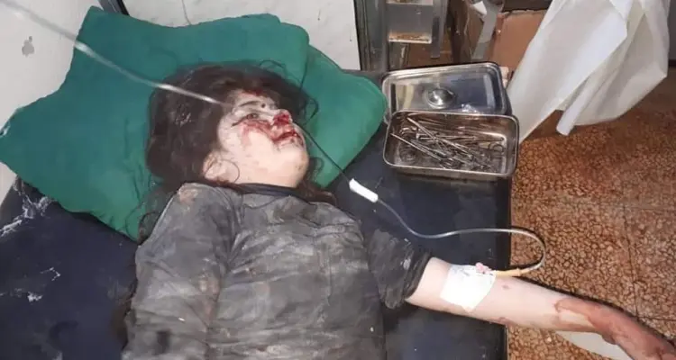 صور للقصف و الجرحى في بلدة كفرعويد بجبل الزاوية في ريف إدلب .: أخبار