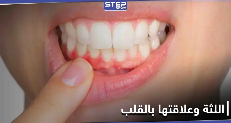 علامات تحذيرية غير معروفة موجودة في الفم قد تكشف أمراض القلب مبكراً: أخبار