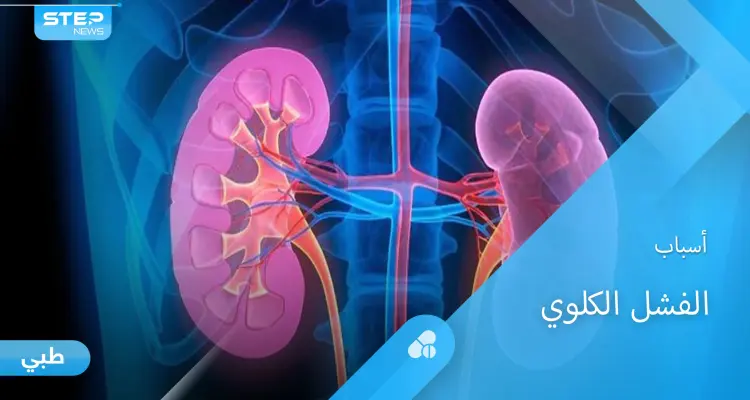 أسباب الفشل الكلوي المزمن وأفضل طرق العلاج إليك أهم المعلومات: أخبار