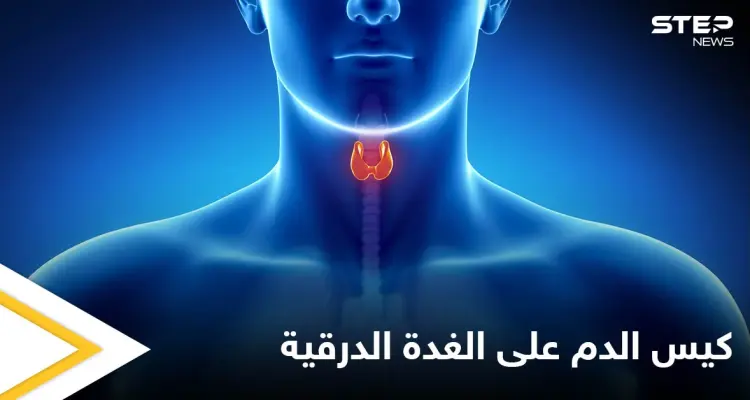 ما هي مخاطر وجود كيس الدم على الغدة الدرقية وأعراضه وطرق العلاج إليك أهم المعلومات: أخبار