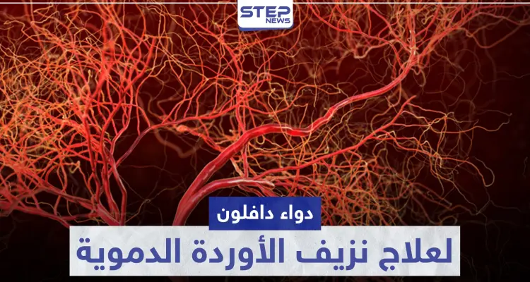 دواء دافلون Daflon لعلاج نزيف الأوردة الدموية: أخبار