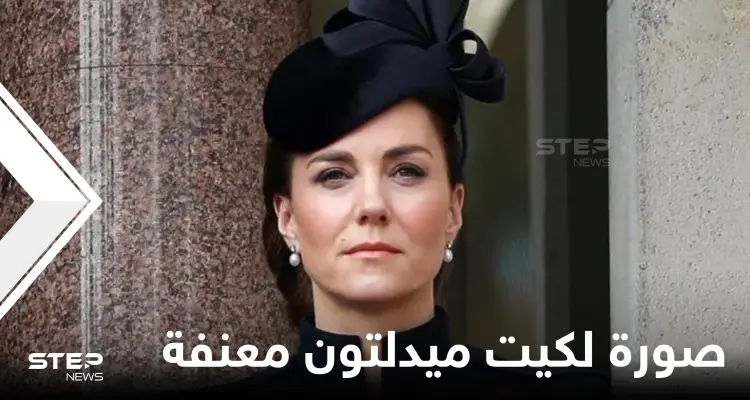 شاهد|| صورة للدوقة كيت ميدلتون معنفة بوجه مشوه تثير الجدل والغضب في بريطانيا: أخبار