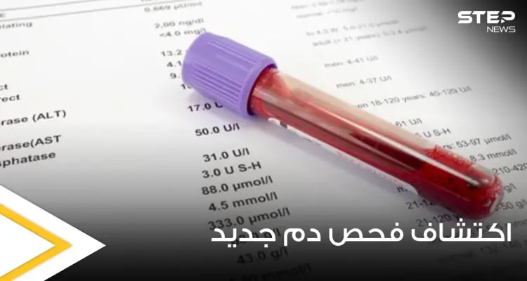 في اختراق عملي مذهل.. التوصل لفحص دم بسيط يكشف 50 نوعاً من السرطان: أخبار