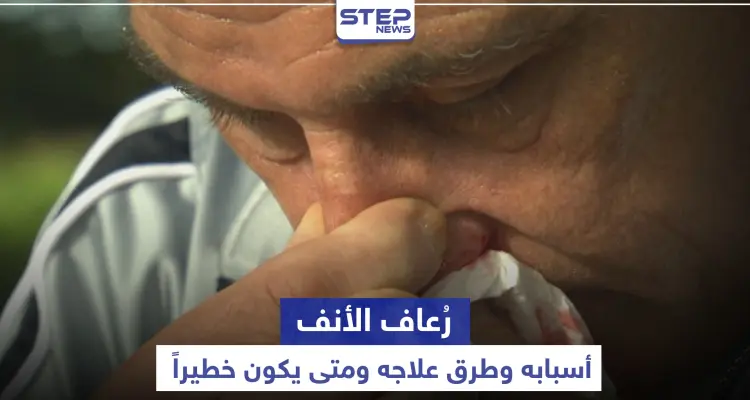 متى يكون رُعاف الأنف خطيراً .. أسبابه وطرق علاجه: أخبار