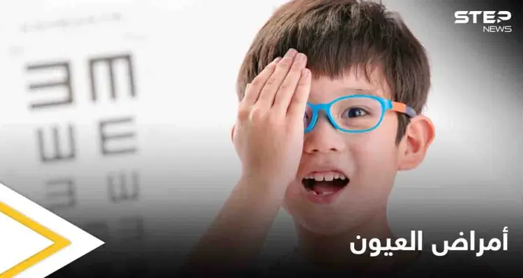 تعرف على أمراض العيون الشائعة لدى الأطفال في المراحل المبكرة وطرق علاجها: أخبار
