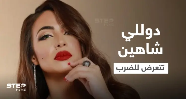دوللي شاهين تتعرض للضرب المبرح وتنشر صور الكدمات التي ظهرت على وجهها وجسدها ومدير أعمالها يوضح (صور): أخبار
