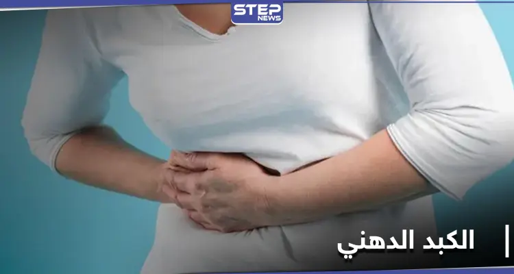أعراض مرض الكبد الدهني.. متى يصيب الأطفال وخطورته على مدمني الكحول: أخبار