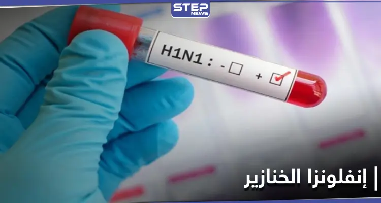 كندا تسجل أوّل حالة إصابة بمرض إنفلونزا الخنازير النادر تزامناً مع ارتفاع إصابات كورونا: أخبار