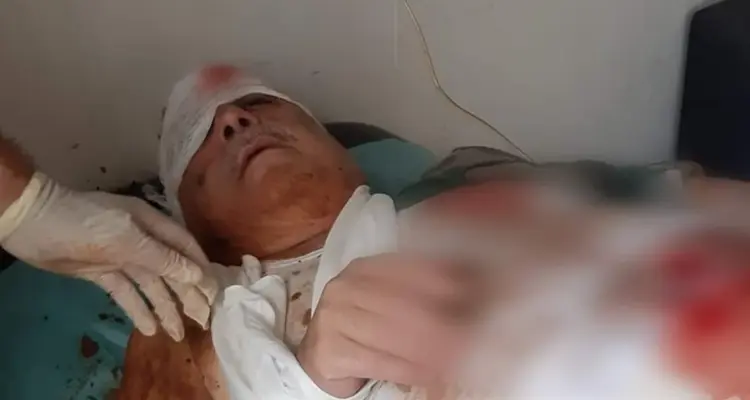 إصابة المسؤول الأول عن مجزرة البيضا بجراح بالغة نتيجة عبوة ناسفة!!: أخبار