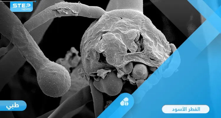 مرض نادر وخطير.. الفطر الأسود أكثر أنواع الفطريات فتكاً تعرف على طرق انتقاله وكيفية علاجه: أخبار