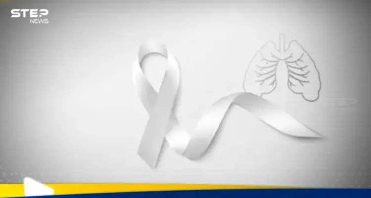 دراسة علمية تكشف سر انتشار سرطان الرئة لدى غير المدخنين: أخبار