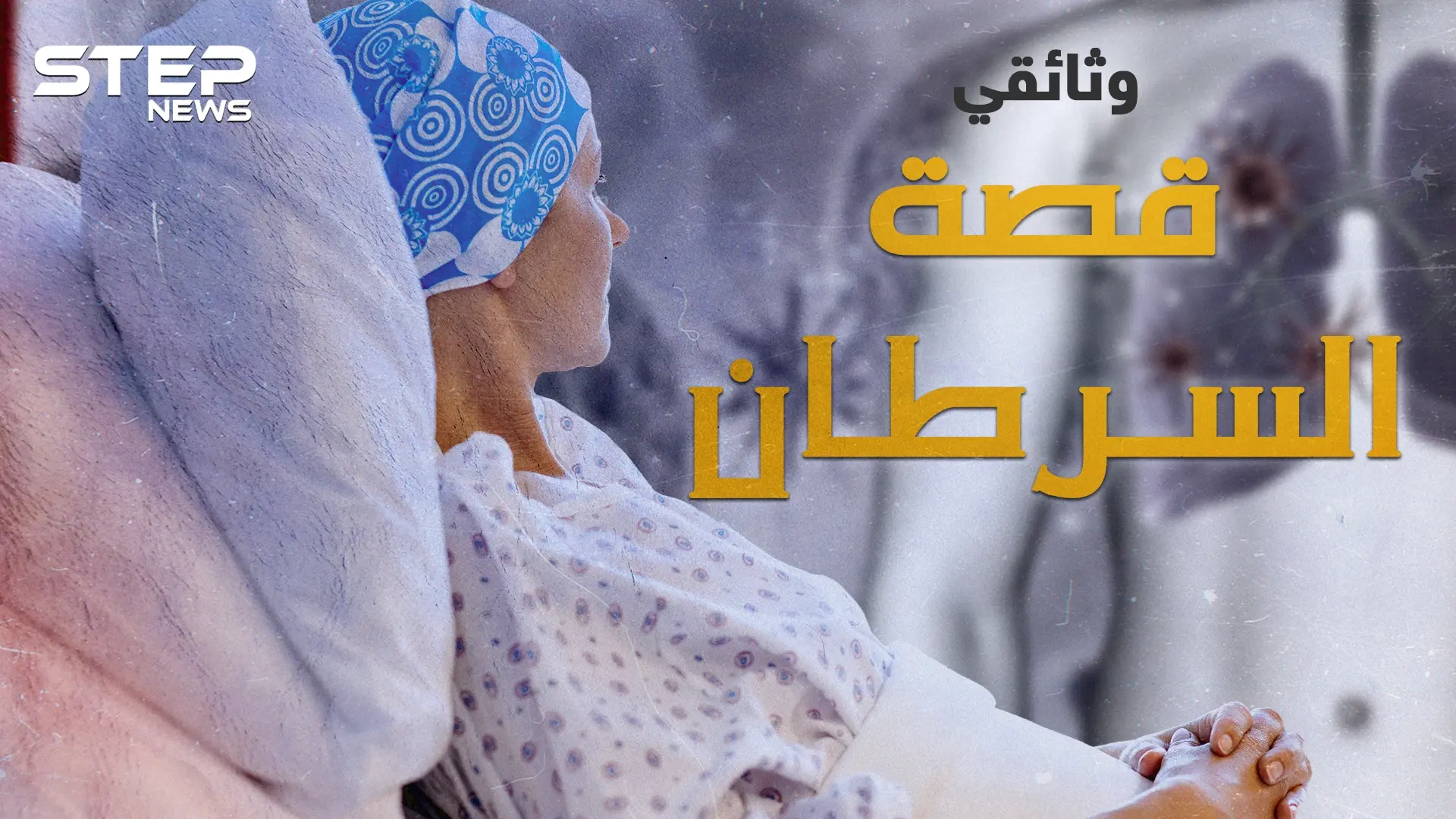 مرض السرطان.. في يومه العالمي ما هي قصة ظهوره قبل آلاف الأعوام وحتى الآن: مرض السرطان