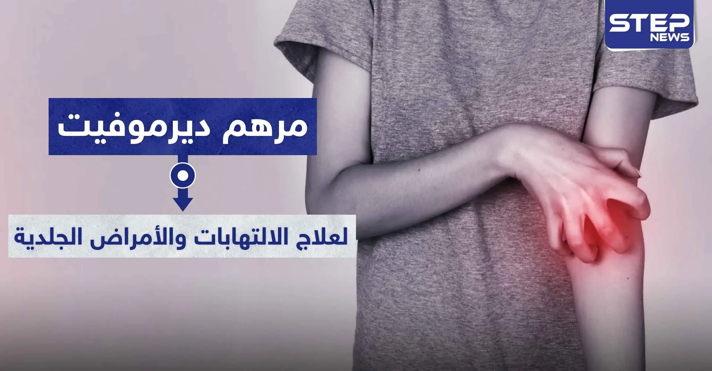 مرهم ديرموفيت Dermovate لعلاج الالتهابات والأمراض الجلدية: استشارة الطبيب