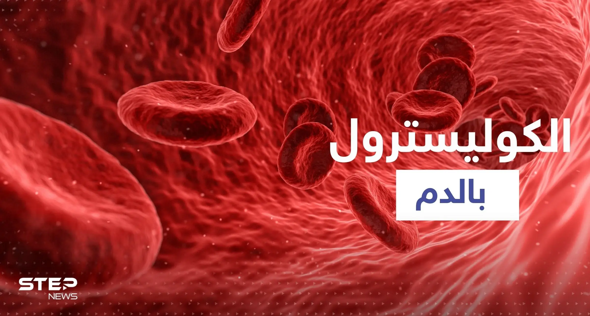 "تصيب الساق ويمكن أن تكون خطيرة".. أول علامة لارتفاع نسبة الكوليسترول: الصحة