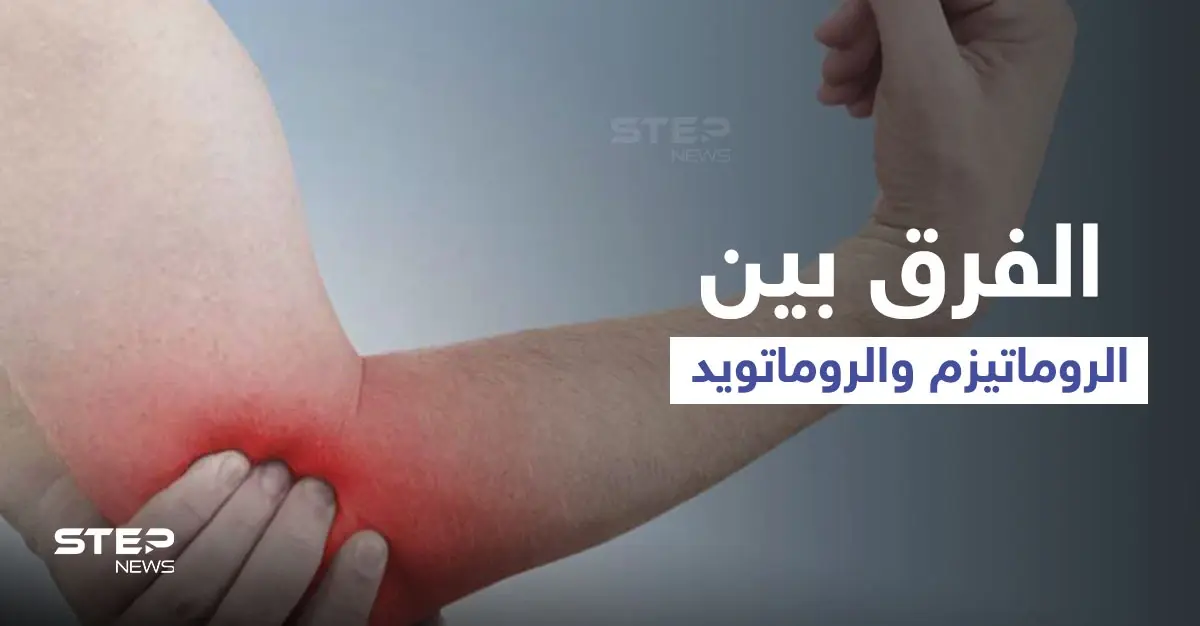 الفرق بين الروماتيزم والروماتويد.. إليك أهم المعلومات: الروماتيزم