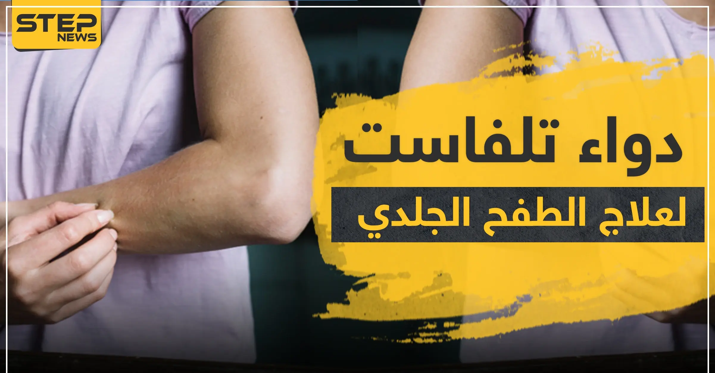 دواء تلفاست لعلاج الطفح الجلدي: جسم الإنسان