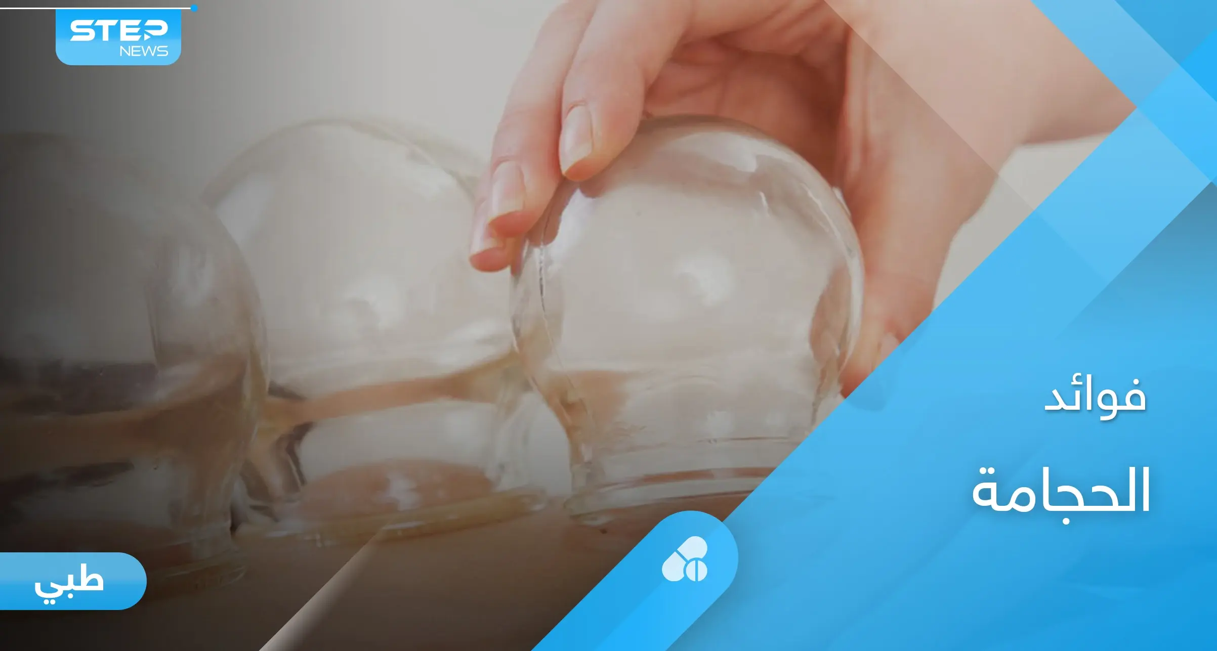 أنواع الحجامة وفوائدها لعلاج الأمراض ونصائح ما بعد الحجامة: الصحة