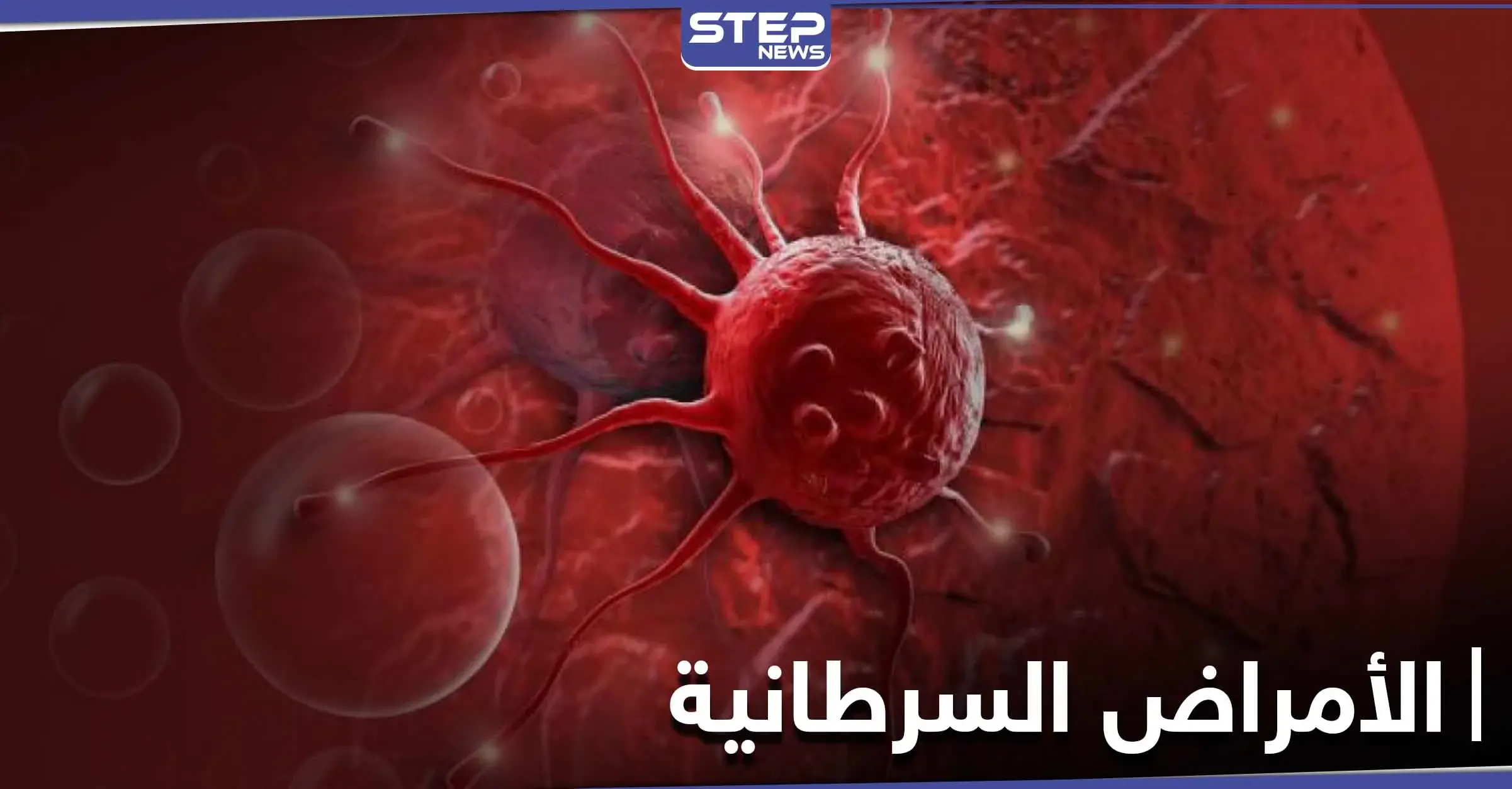 نصائح هامة عليك معرفتها.. لتجنب الإصابة بالأمراض السرطانية القاتلة: العلماء