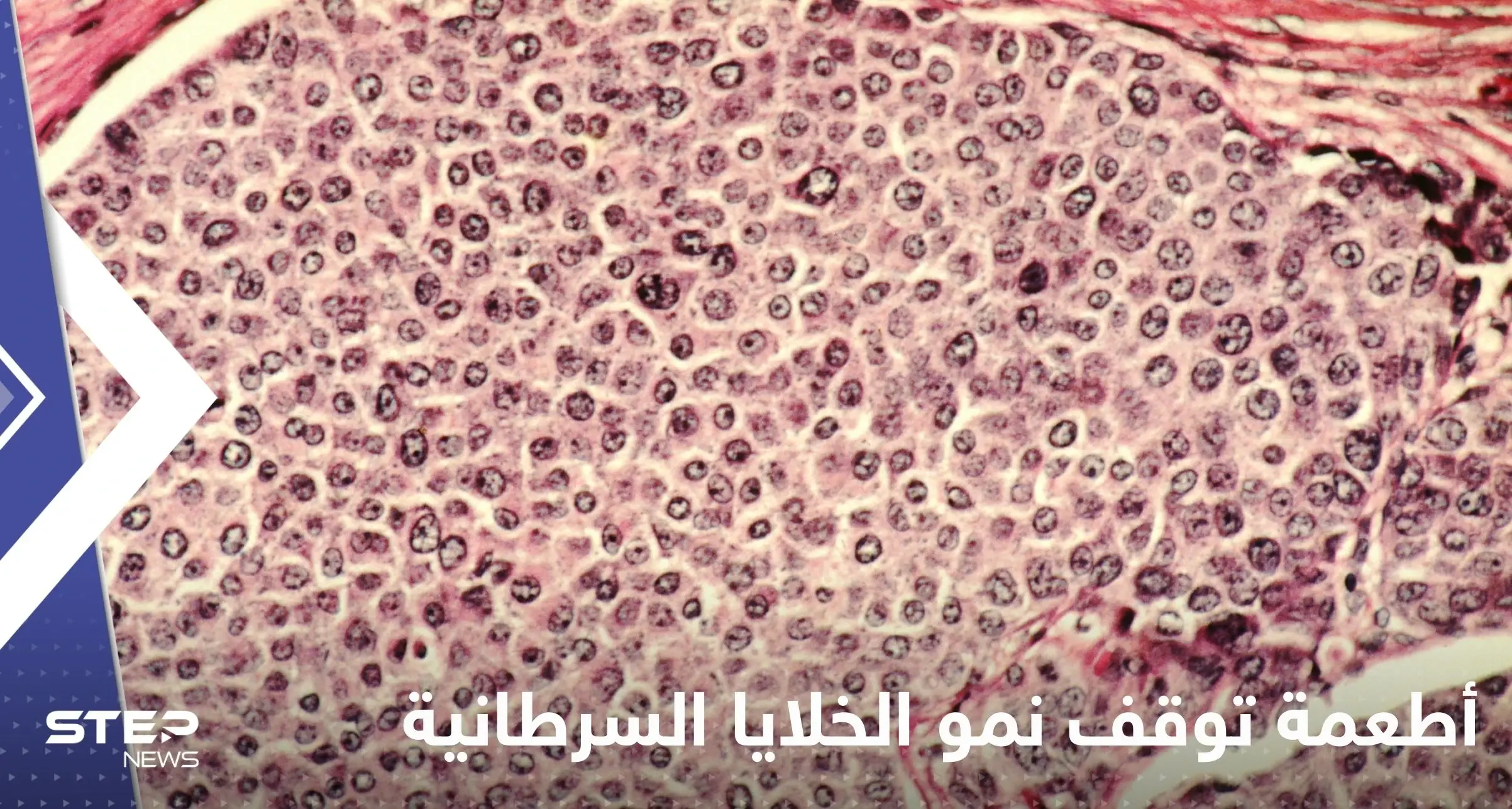 علماء يكتشفون أطعمة توقف نمو الخلايا السرطانية في الجسم وتمنع انتشارها: صحة وعلاج