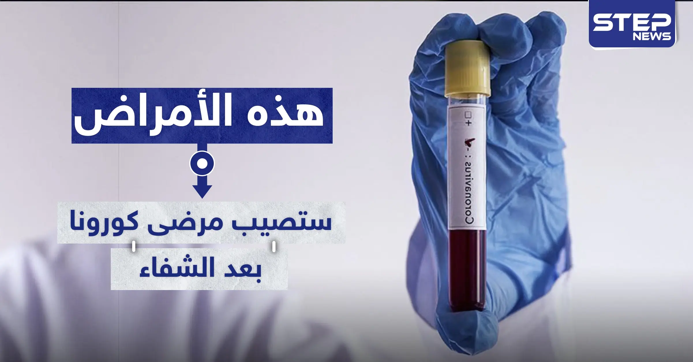 دراسة تكشف الأمراض التي ستصيب مرضى "كورونا" بعد الشفاء من الفيروس: ضغط الدم